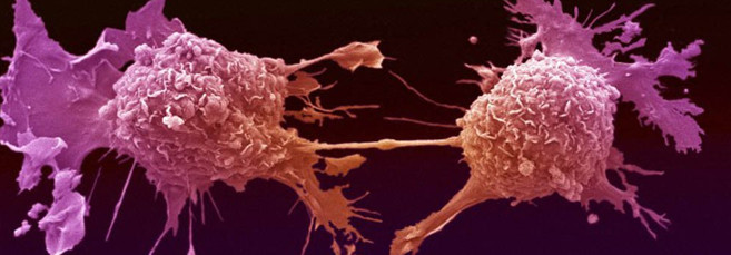 Алкоголь повышает вероятность возникновение рака