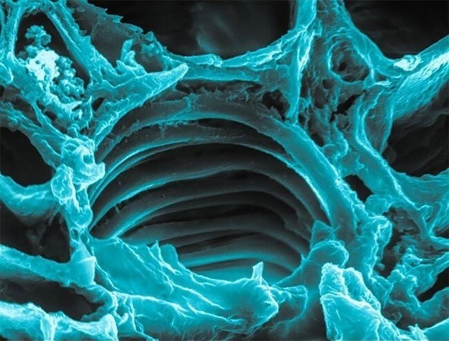 Спиральная клетка